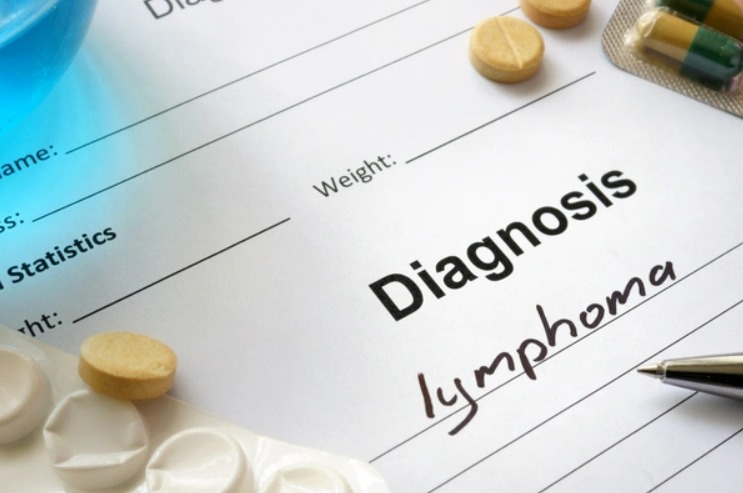 Was ist ein Lymphom? Wie wird Lymphdrüsenkrebs behandelt?