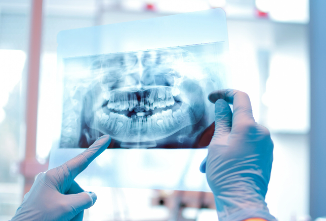 Gesunde Zähne mit dreidimensionaler Mund-Scan-Technologie