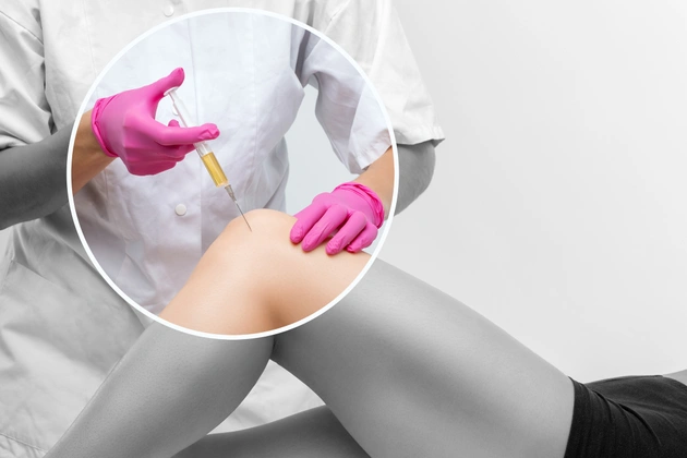 PRP-Injektion bei Arthrose im Knie