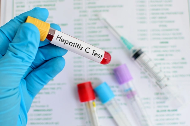 Hepatitis-C-Impfstoff