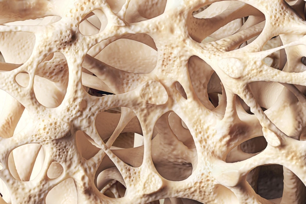 Was will die Osteoporose-Klinik erreichen?